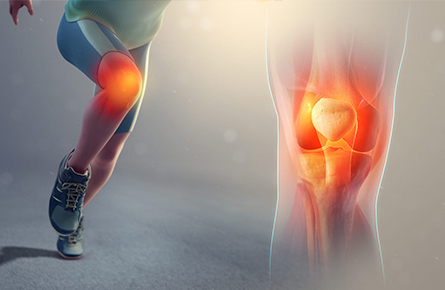 The Mechanism of Action of Knee Braces on the Meniscus
